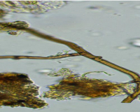 
		Regeneració de sòls a partir de la microbiologia
	